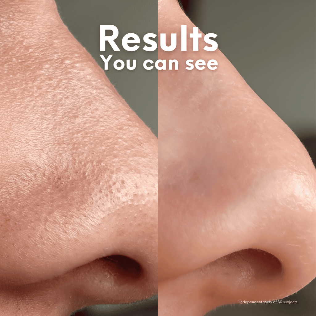 Breakout Patch Classic Nose-1