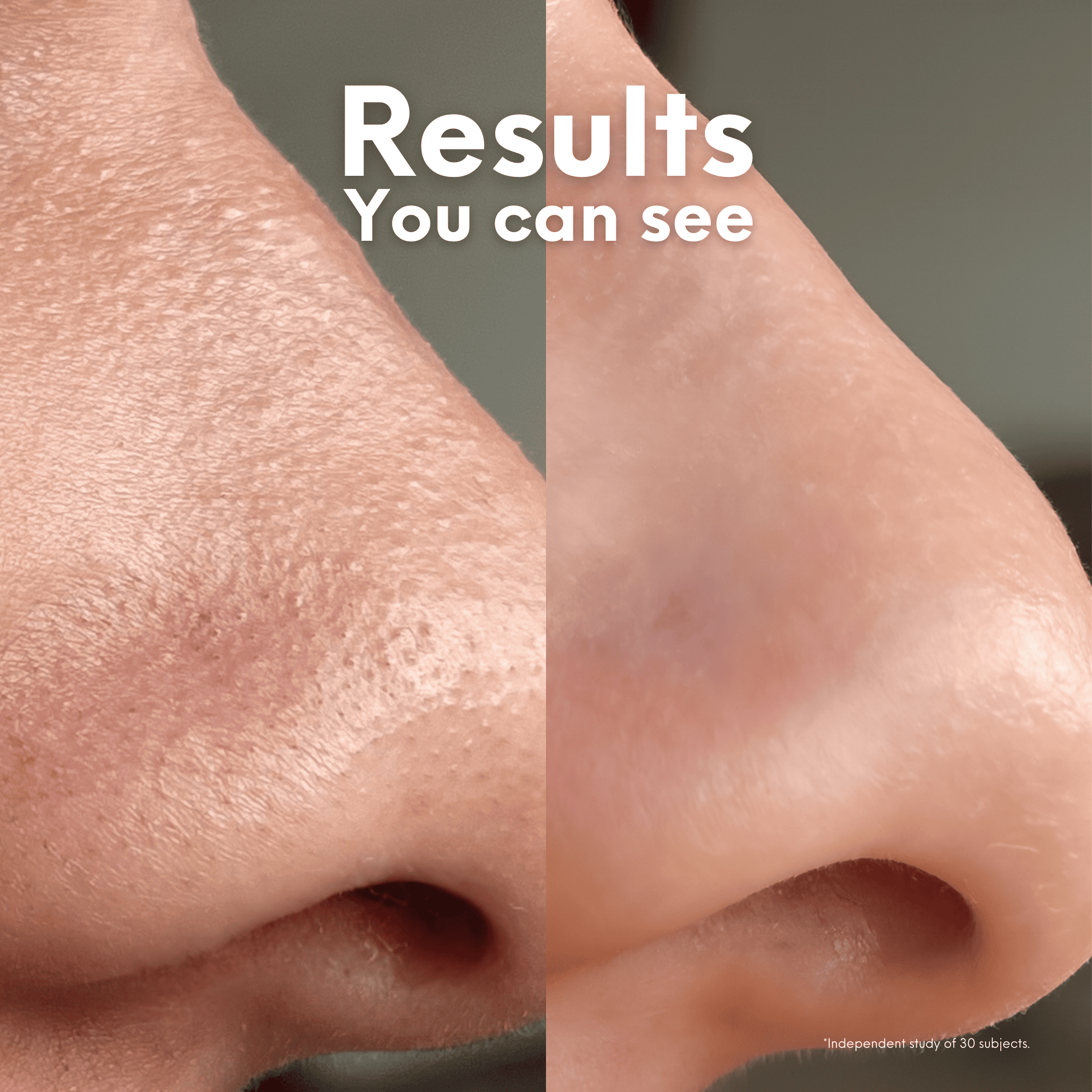 Breakout Patch Classic Nose-1